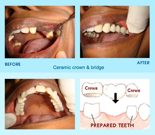 What are some different types of dental diagrams?